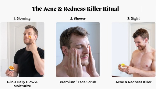 Norse Organics Acne Killer Ritual Review